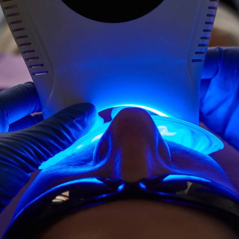 Close-up,Portrait,Of,A,Female,Patient,At,Dentist,In,The