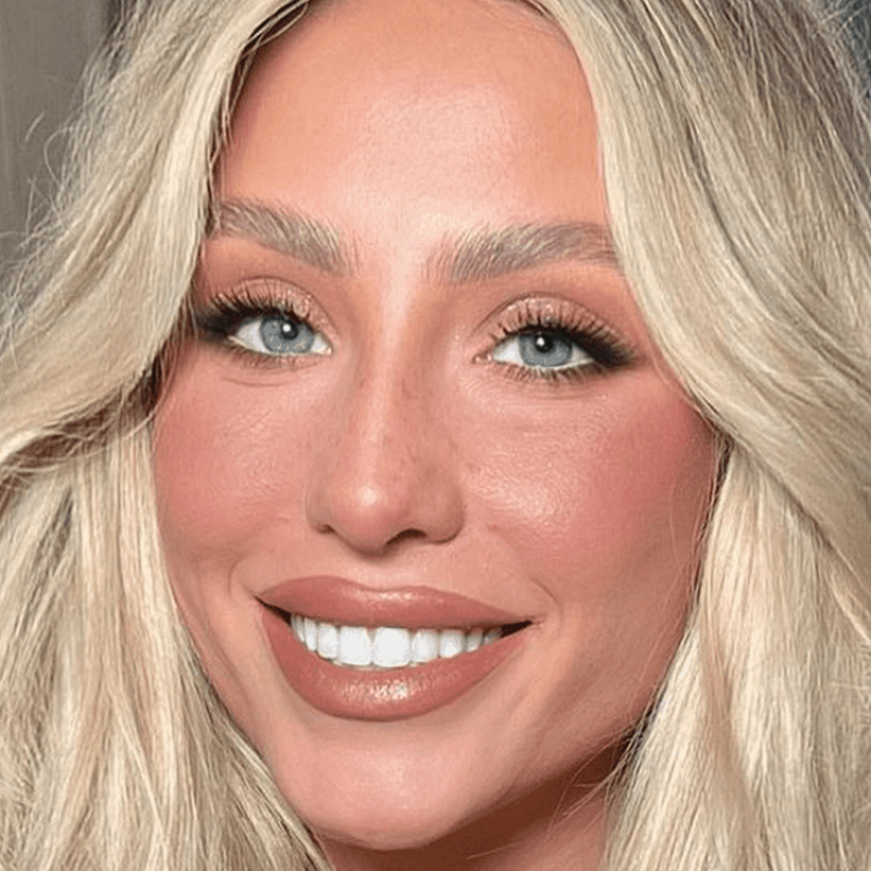 whitenteeth-4dbb28a71d9d4fdc90d86a830def049a